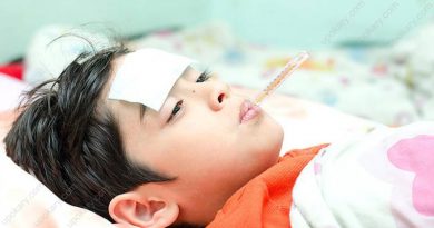typhoid fever