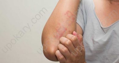Allergy