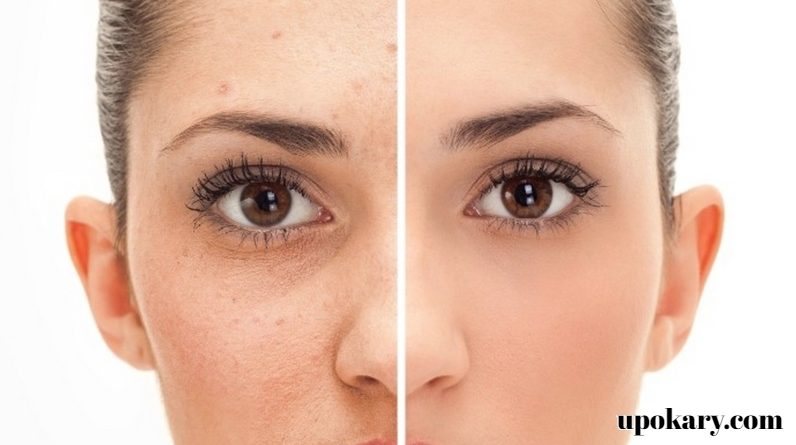 face-spot