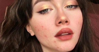 acne on face