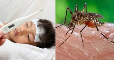 dengue fever