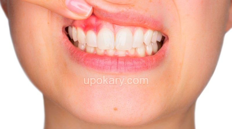 gum pain