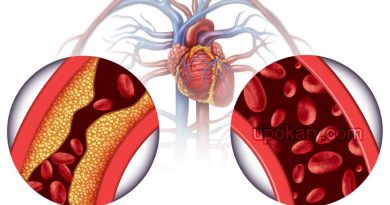 Cholesterol