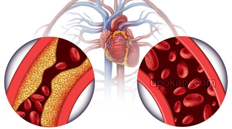Cholesterol
