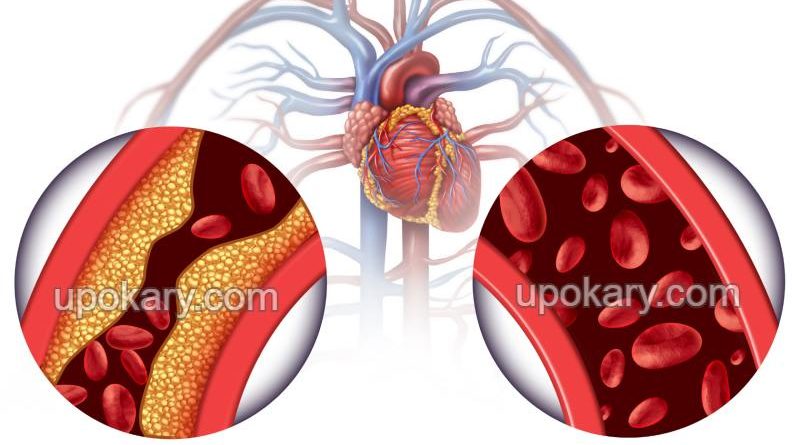 cholesterol