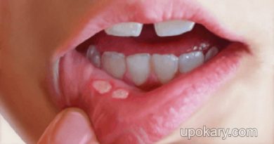 face-sores