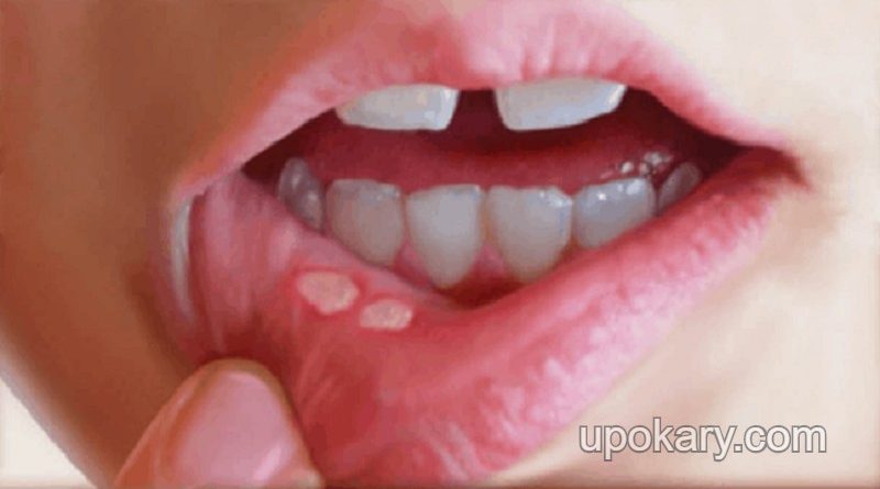 face-sores