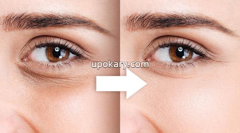 eye
