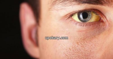 Jaundice