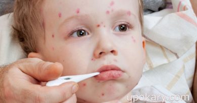 pox sisu