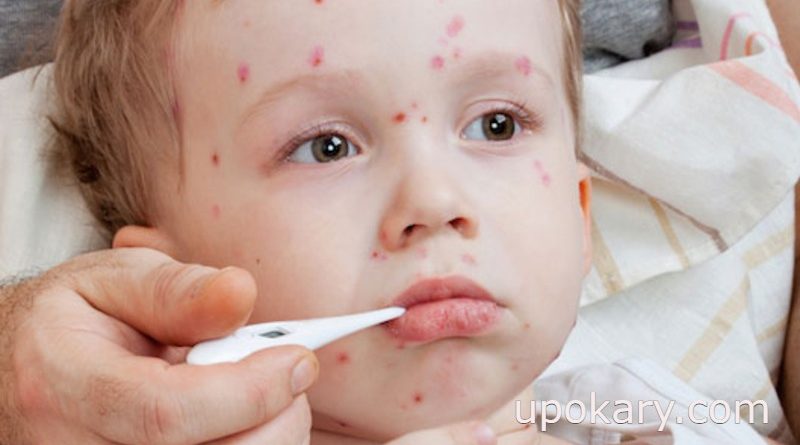pox sisu