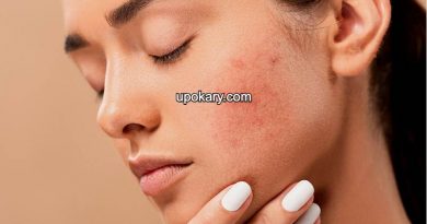 Food casue acne
