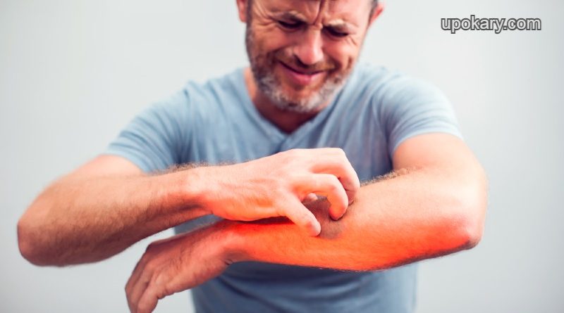 itching-skin (1)