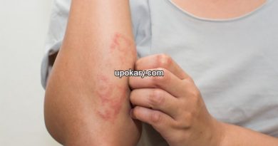 skinrash