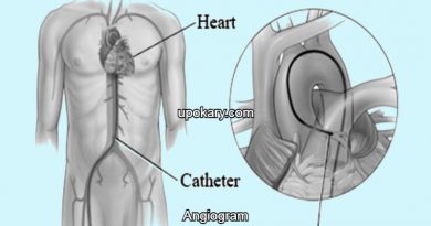 Angiogram