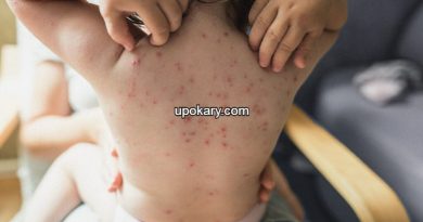 pox