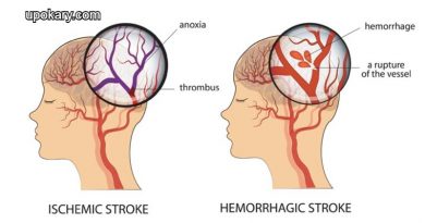 haemorrhagic