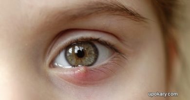 stye