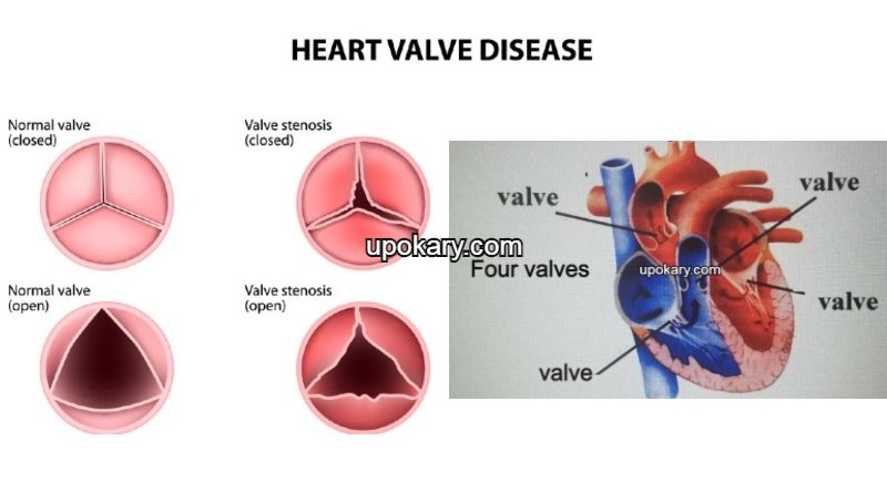 valve