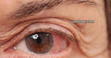 Glaucoma