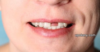 Missing Tooth