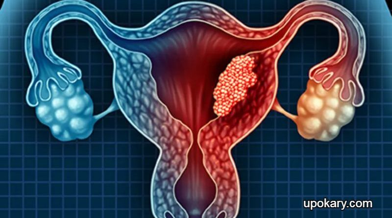 Uterine cancer