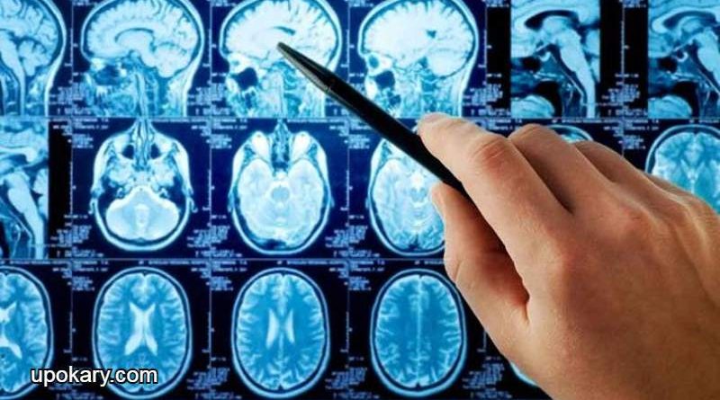 Brain Tumours