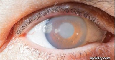 What is glaucoma