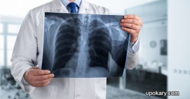 X-ray