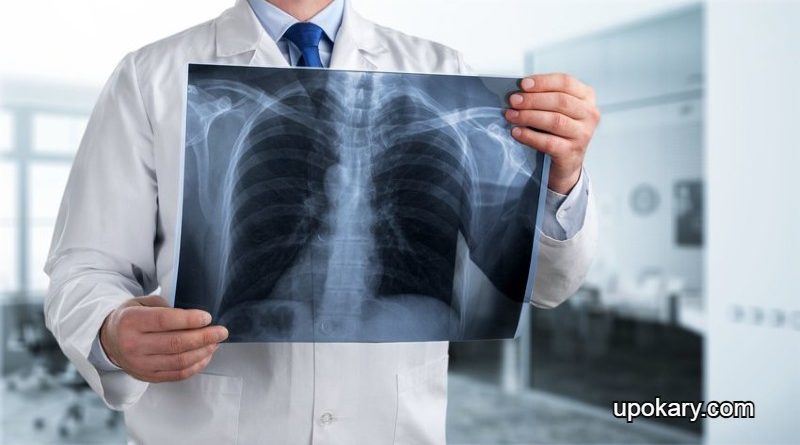 X-ray