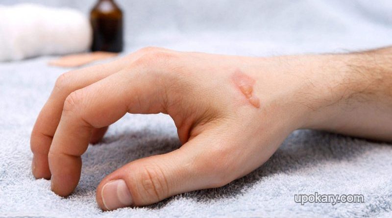 hot-oil