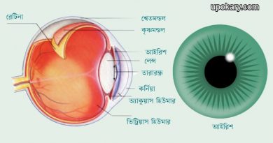 Eye