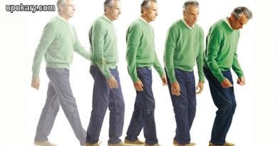 Parkinson