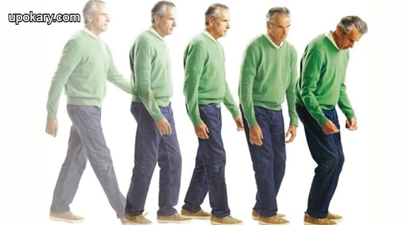 Parkinson