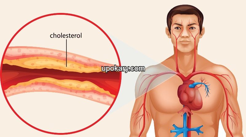 cholesterol