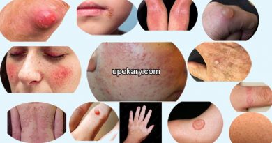 Skin-Disorder