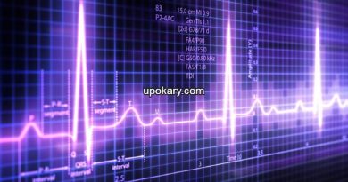 ecg