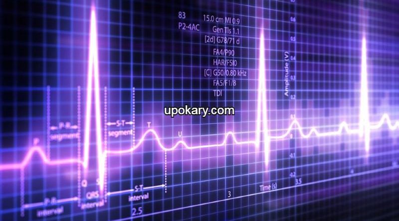 ecg