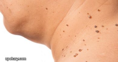 skin_tags