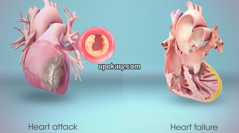 heart_failure