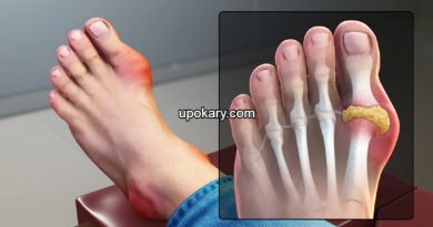 Gout_Signs