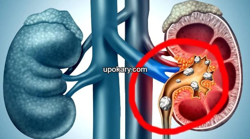 Kidney