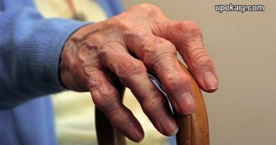 Arthritis