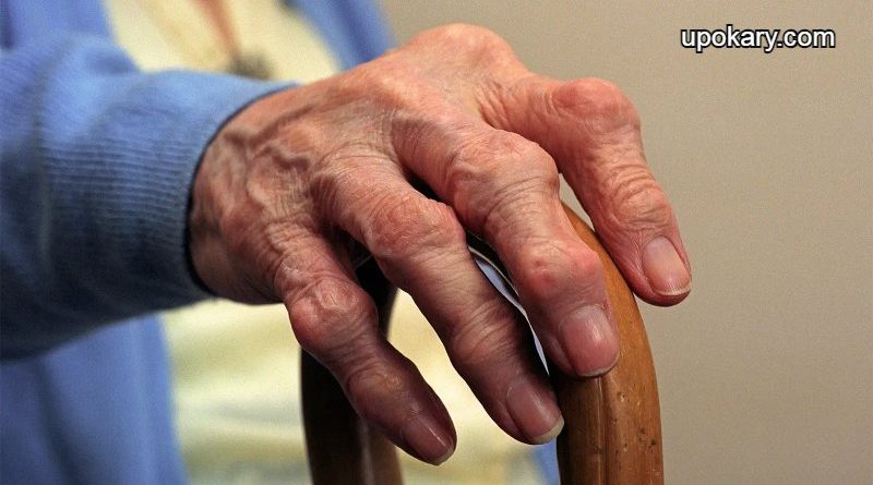Arthritis