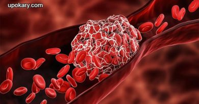 Blood_clots
