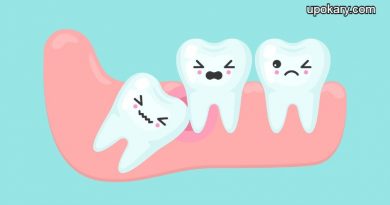 wisdom_teeth