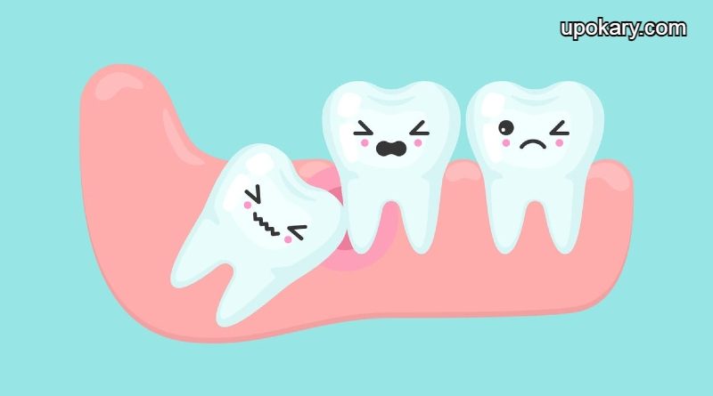 wisdom_teeth