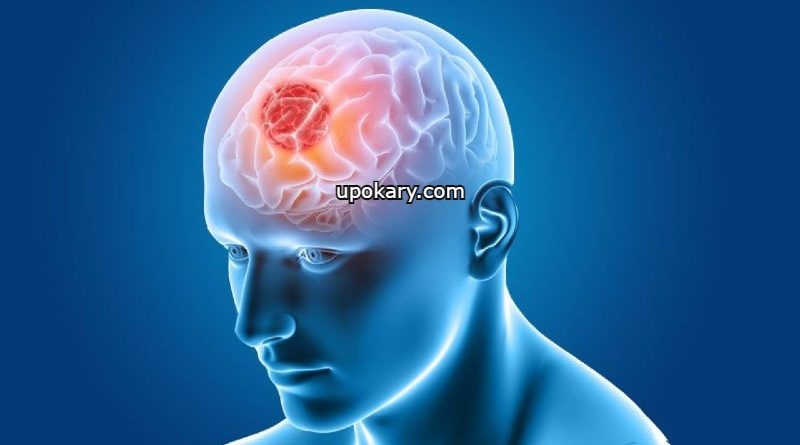 brain tumours