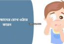 eye pain